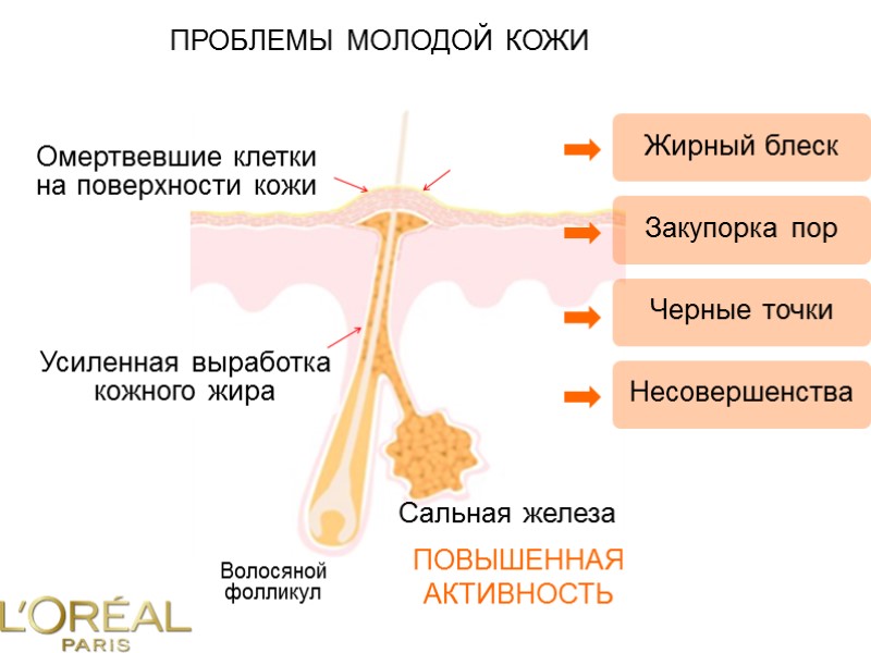 ПРОБЛЕМЫ МОЛОДОЙ КОЖИ Сальная железа Волосяной фолликул Усиленная выработка кожного жира Омертвевшие клетки на